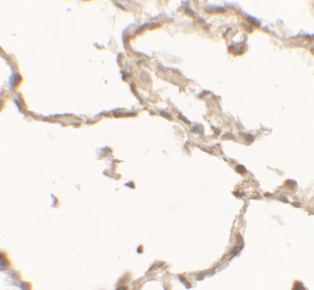 Immunohistochemistry of DDC in human lung tissue with DDC antibody at 2