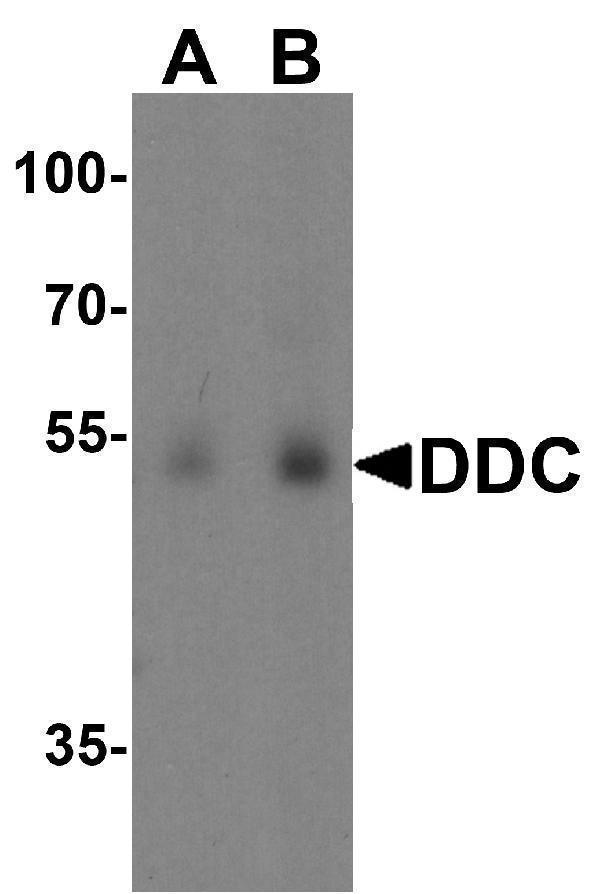 Western blot analysis of DDC in human lung tissue lysate with DDC antibody at (A) 0