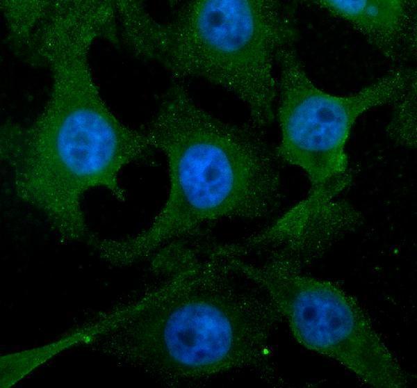 IF analysis of SLCO1B1 using anti-SLCO1B1 antibody (A01375-2)