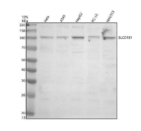 Western blot analysis of SLCO1B1 using anti-SLCO1B1 antibody (A01375-2)