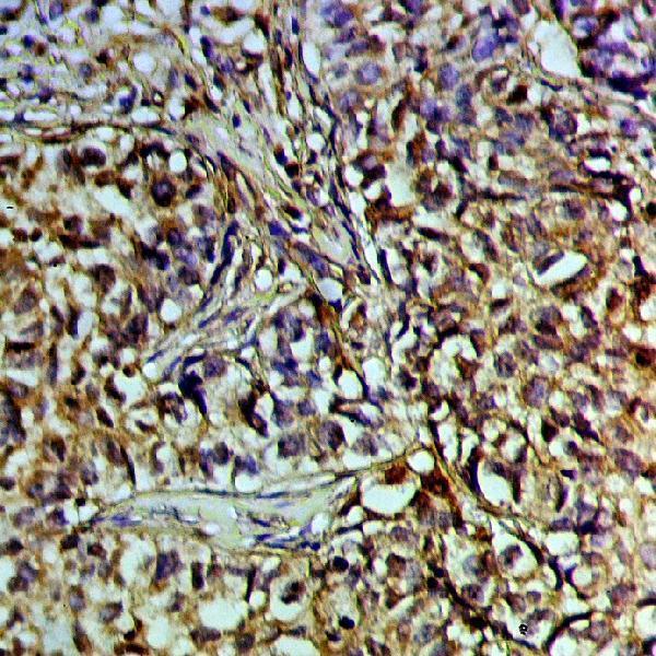 a01376 2 poli primary antiboties ihc testing 2