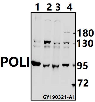 a01376 2 poli primary antiboties wb testing 1