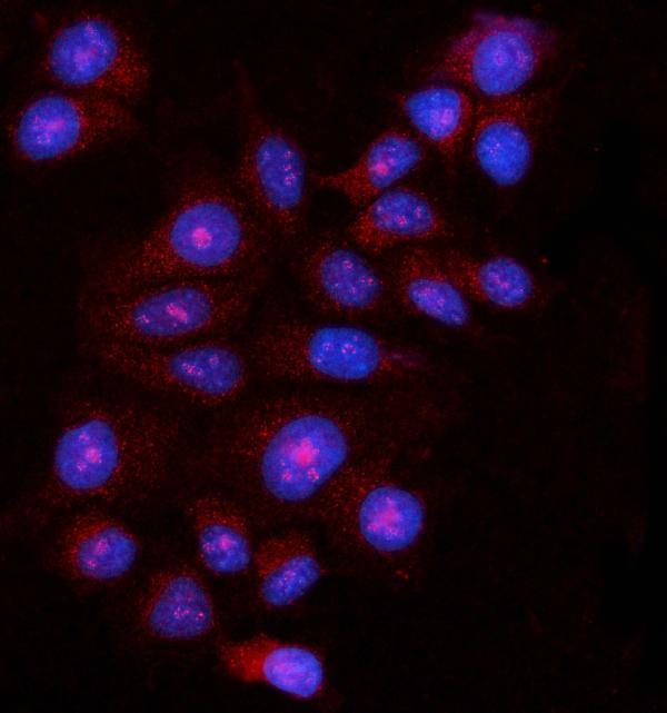  IF analysis of FBP1 using anti-FBP1 antibody (A01377-1)