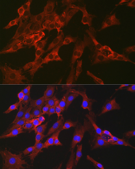 Immunofluorescence analysis of C6 cells using FBP1 Rabbit pAb  at dilution of 1:100 