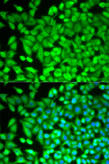 Immunofluorescence analysis of NIH-3T3 cells using FBP1 Rabbit pAb  at dilution of 1:100 