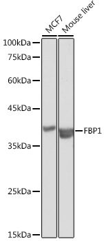 Western blot analysis of extracts of various cell lines, using FBP1 antibody  at 1:1000 dilution