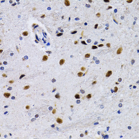 a01379 id3 primary antiboties ihc testing 1