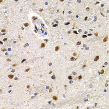 a01379 id3 primary antiboties ihc testing 2