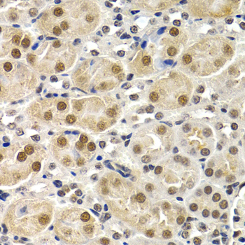 a01379 id3 primary antiboties ihc testing 3