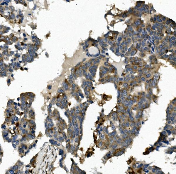 a01380 1 me2 primary antibodies ihc testing 3