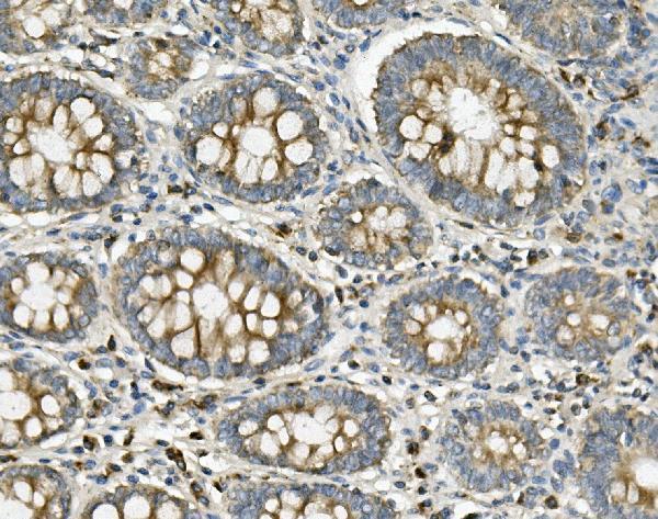 a01380 1 me2 primary antibodies ihc testing 4