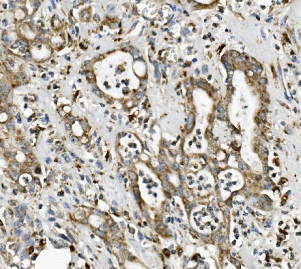 a01380 1 me2 primary antibodies ihc testing 5