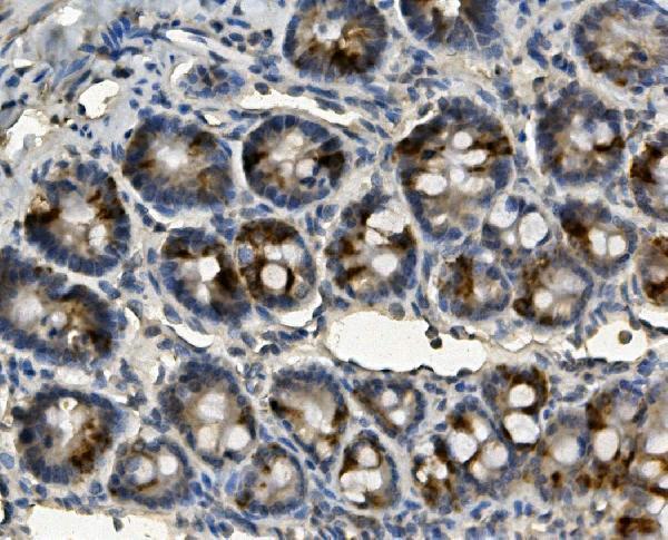 a01380 1 me2 primary antibodies ihc testing 6