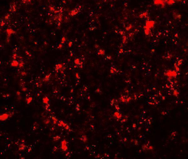 Immunofluorescence of ME2 in human spleen tissue with ME2 antibody at 20 μg/mL