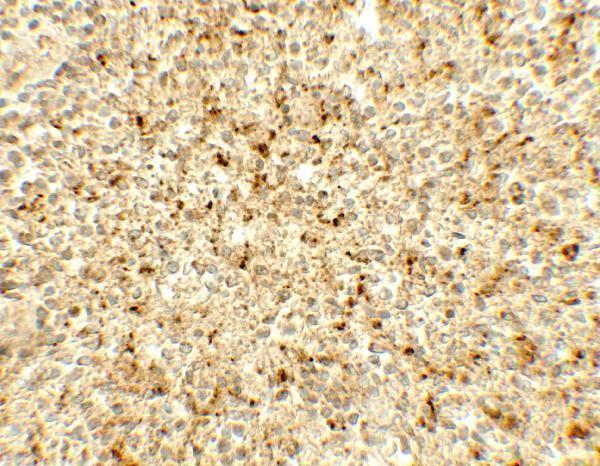 Immunohistochemistry of ME2 in human spleen tissue with ME2 antibody at 5 μg/mL
