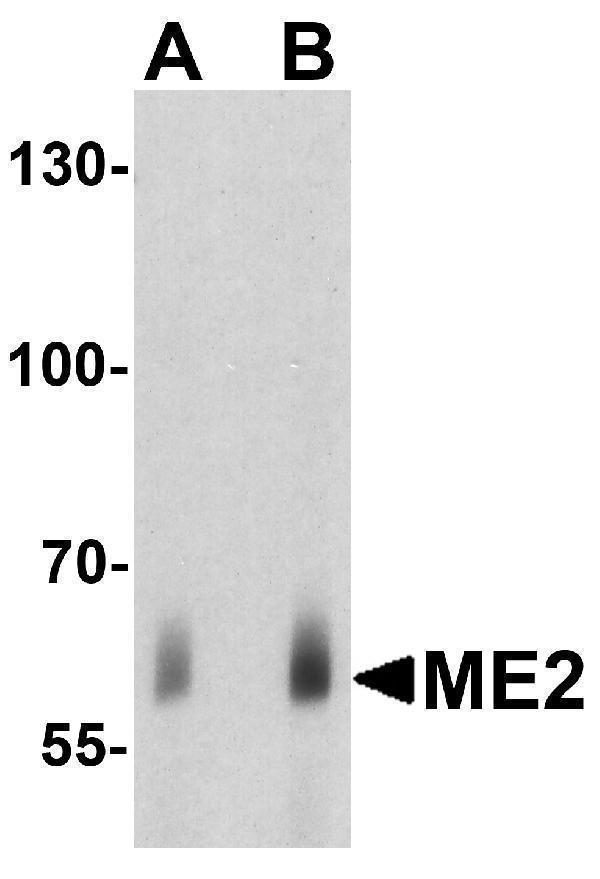 Western blot analysis of ME2 in human spleen tissue lysate with ME2 antibody at (A) 1 and (B) 2μg/ml