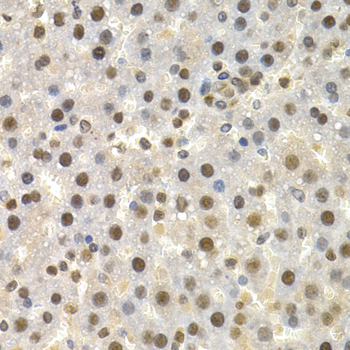 Immunohistochemistry of paraffin-embedded rat liver using TorsinA/TOR1A antibody  at dilution of 1:200 
