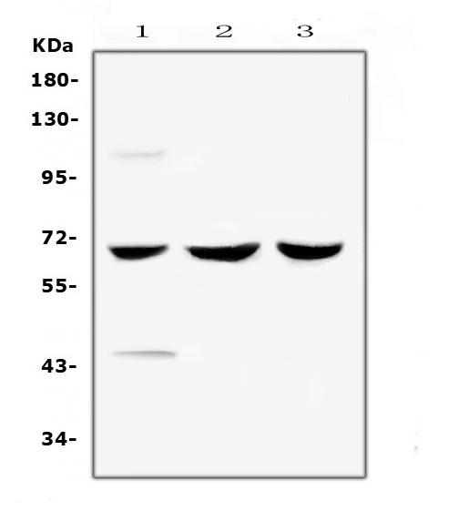 Western blot analysis of SPHK2 using anti-SPHK2 antibody (A01382-1). Electrophoresis was performed on a 5-20% SDS-PAGE gel at 70V (Stacking gel) / 90V (Resolving gel) for 2-3 hours. The sample well of each lane was loaded with 50ug of sample under reducing conditions. Lane 1: human COLO-320 whole cell lysates, Lane 2: human HepG2 whole cell lysates, Lane 3: human 22RV1 whole cell lysates. After Electrophoresis, proteins were transferred to a Nitrocellulose membrane at 150mA for 50-90 minutes. Blocked the membrane with 5% Non-fat Milk/ TBS for 1.5 hour at RT. The membrane was incubated with rabbit anti-SPHK2 antigen affinity purified polyclonal antibody (Catalog # A01382-1) at 0.5 μg/mL overnight at 4°C, then washed with TBS-0.1%Tween 3 times with 5 minutes each and probed with a goat anti-rabbit IgG-HRP secondary antibody at a dilution of 1:10000 for 1.5 hour at RT. The signal is developed using an Enhanced Chemiluminescent detection (ECL) kit (Catalog # EK1002) with Tanon 5200 system. A specific band was detected for SPHK2 at approximately 69KD. The expected band size for SPHK2 is at 69KD.