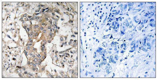 a01382 sphk2 primary antibodies ihc testing 1