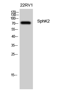 a01382 sphk2 primary antibodies wb testing 2