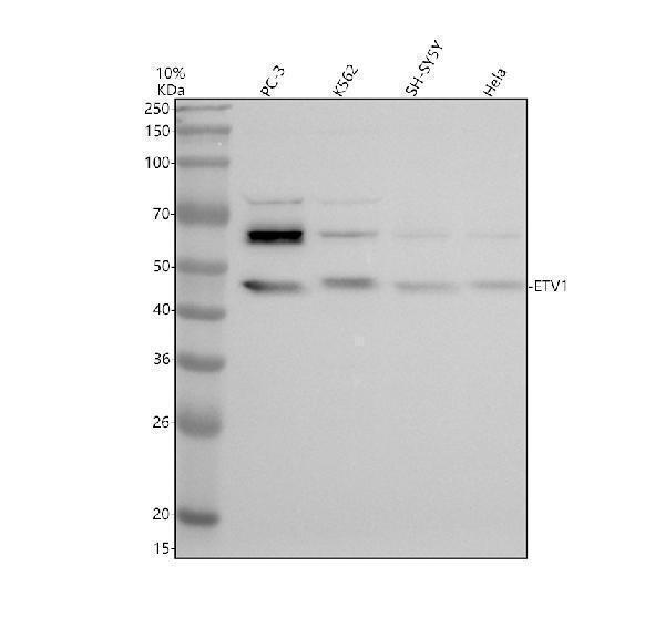a01383 3 etv1 primary antibodies wb testing 1