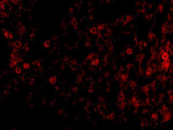 a01384 1 eif2ak2 primary antibodies if testing 3