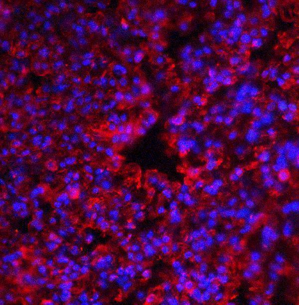 a01384 1 eif2ak2 primary antibodies if testing 5