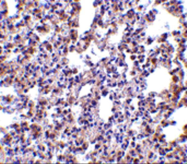 a01384 1 eif2ak2 primary antibodies ihc testing 4