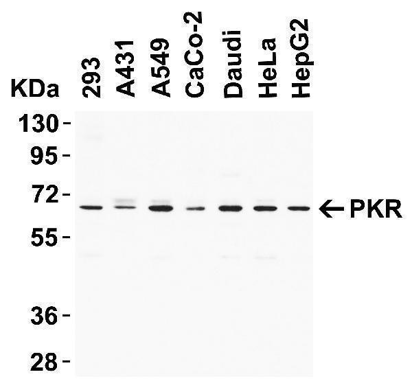 a01384 1 eif2ak2 primary antibodies wb testing 1