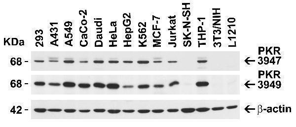 a01384 1 eif2ak2 primary antibodies wb testing 2