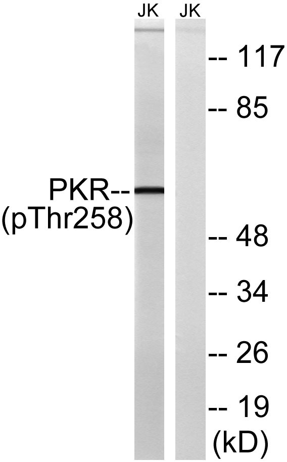 Western blot analysis of lysates from Jurkat cells treated with starved 24h, using PKR (Phospho-Thr258) Antibody