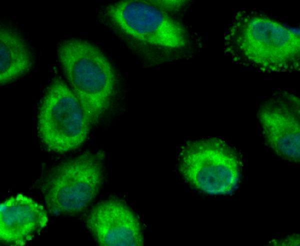 ICC staining Mib1 in HUVEC cells (green)