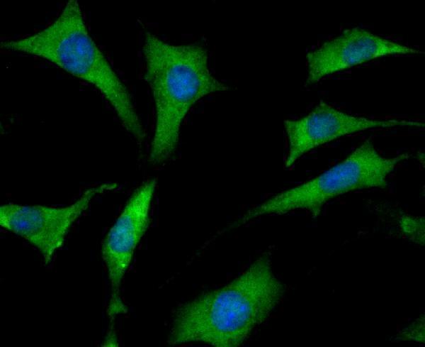ICC staining Mib1 in SH-SY-5Y cells (green)