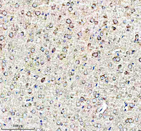  IHC analysis of TrkB/NTRK2 using anti-TrkB/NTRK2 antibody (A01388-4)