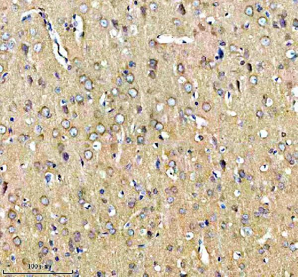  IHC analysis of TrkB/NTRK2 using anti-TrkB/NTRK2 antibody (A01388-4)