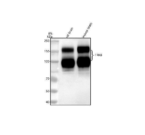  Western blot analysis of TrkB/NTRK2 using anti-TrkB/NTRK2 antibody (A01388-4)