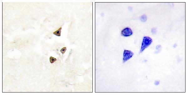 Immunohistochemistry analysis of paraffin-embedded human brain, using Trk B (Phospho-Tyr515) Antibody