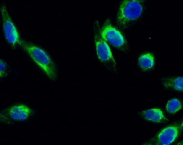 a01388y706 1 ntrk2 primary antibodies if testing 5