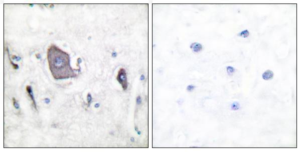 Immunohistochemistry analysis of paraffin-embedded human brain, using Trk B (Phospho-Tyr705) Antibody