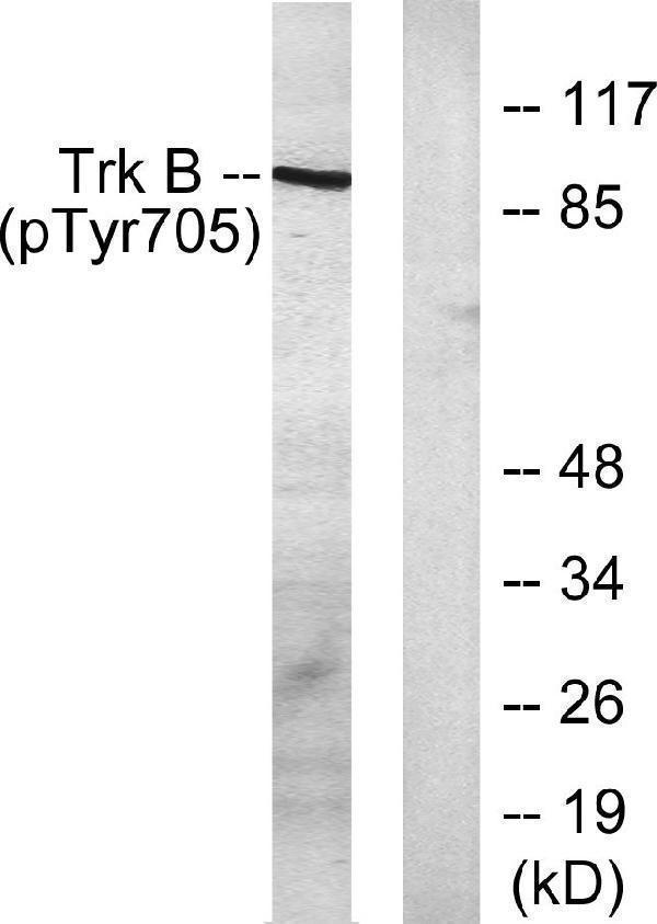 Western blot analysis of lysates from mouse kidney, using Trk B (Phospho-Tyr705) Antibody