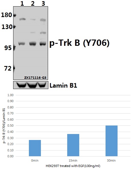 Western blot (WB) analysis of Trk B (phospho-Y706) polyclonal antibody at 1:500 dilution
Lane1:HEK293T whole cell lysate(40ug)
Lane2:HEK293T treated with EGF(100ng/ml,5 minutes) whole cell lysate(40ug)
Lane3:HEK293T treated with EGF(100ng/ml,30 minutes) whole cell lysate(40ug)
