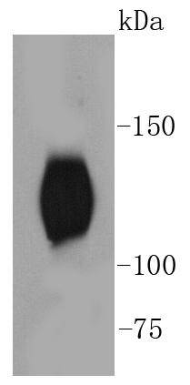 Western blot analysis of phospho -TrkB(Y817) on mouse brain lysates using anti- phospho -TrkB(Y817) antibody at 1/1,000 dilution
