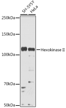 a01389 1 hk2 primary antiboties wb testing 2