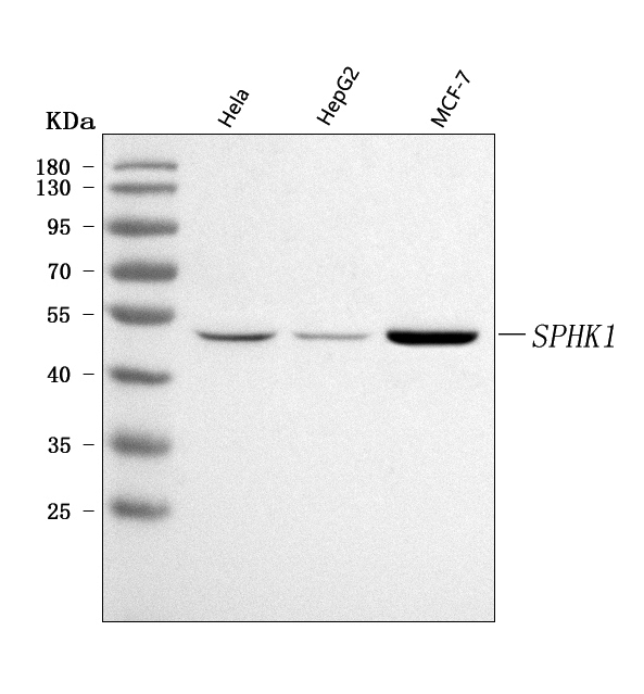  Western blot analysis of SPHK1 using anti-SPHK1 antibody (A01390-2)