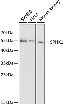 WesternBlot (WB) analysis of SPHK1 polyclonal antibody