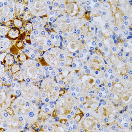 a01391 2 tff1 primary antiboties ihc testing 3