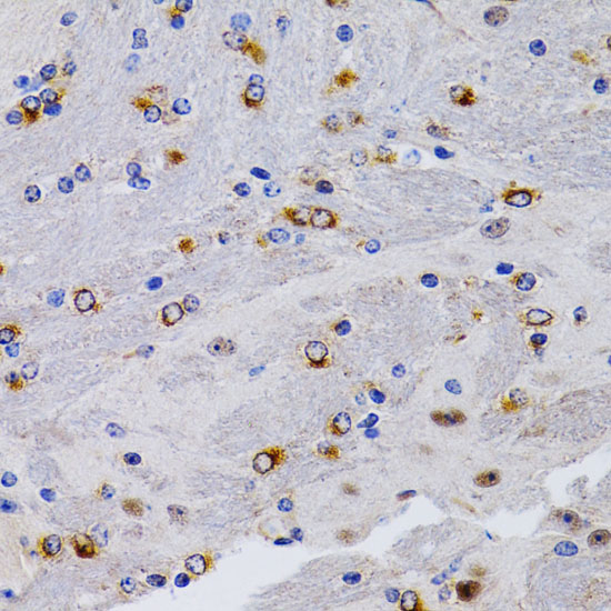 a01391 2 tff1 primary antiboties ihc testing 4