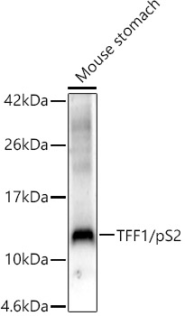 a01391 2 tff1 primary antiboties wb testing 2