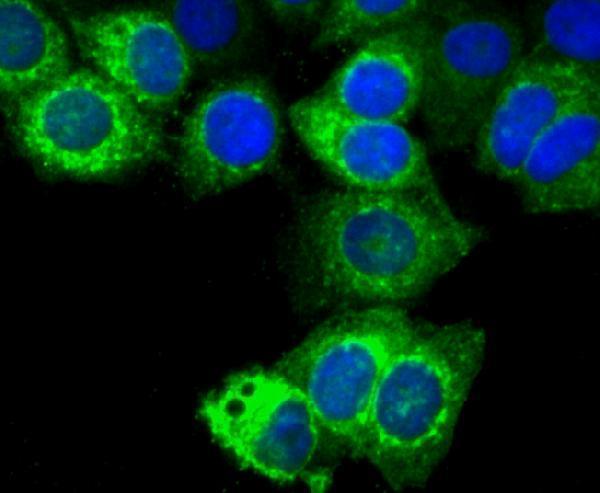 a01391 3 tff1 primary antiboties icc testing 2