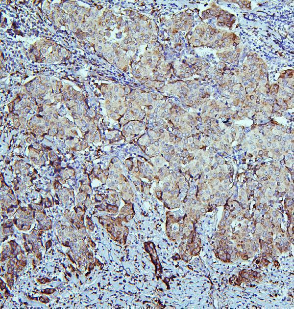 a01392 aldh1a1 primary antibodies ihc testing 4
